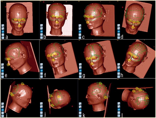 Figure 4. Range of lines for LBR in different areas: row 1 is LBR in Sphenoid-Temporal part: a–d show single(100 points), double (200 points), triple (300 points) and quartic (400 points) lines respectively; row 2 is LBR in Parietal-Temporal part: e–h show single (100 points), double (200 points), triple (300 points) and quartic (400 points) lines respectively; row 3 is LBR in Occipital part: i–l show single once(100 points), double (200 points), triple (300 points) and quartic (400 points) lines) respectively.