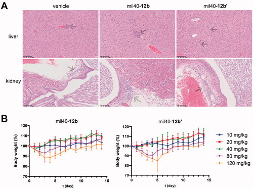 Figure 8. (A) Histopathological studies of the ADC mil40-12b at 20 mg/kg. Traditional maleimide linker-containing ADC mil40-12b′ was used as a control; n = 3/group. Arrows indicate mild multifocal mononuclear cell infiltration, a common incidental or spontaneous lesion in experimental CD-1 mice, independent of the test substance. (B) Changes in the body weights of female CD-1 mice. The data points represent the mean body weight ± SD, n= 3/group.