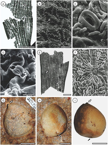Figure 3. Comparative Eocene Australian Pterostoma fossils described by Hill (Citation1980). A–D, Pterostoma zamioides from Anglesea (P150055 and AN 2284), Victoria, E, F, P. anastomans from Nerriga, New South Wales (N0157); all samples held at the Melbourne Museum. A, Pinna fragment (AN 2284) showing anastomosing veins (arrows); B, SEM of P150055 adaxial surface showing strongly sinuous anticlinal cell walls; C, SEM of P150055 stomatal ring and cuticular ridges; D, SEM of P150055 stomate (interior view) showing guard cell flanges; E, Pinna fragment of distal pinna fragment of N0157 showing anastomosing veins (arrows); F, SEM of N0157 intercostal cells showing cuticular ridges, a trichome base (arrow) and sunken stomata with prominent rings; G, Cycad-like ?Avicennia diaspore (OU 30770) described from Landslip Hill by Campbell (Citation2002) showing short apical beak (arrow); H, Cycad-like ?Avicennia diaspore (OU 30771) described from Landslip Hill by Campbell (Citation2002) showing basal attachment scar (arrow); I, Cycas revoluta Thunb. seed showing short apical beak (white arrow) and basal attachment (hilum) scar (black arrow). Scale bars A, E = 2 mm B, F = 50 µm, C, D = 20 µm, G–I = 10 mm; photos A–F courtesy of Bob Hill.
