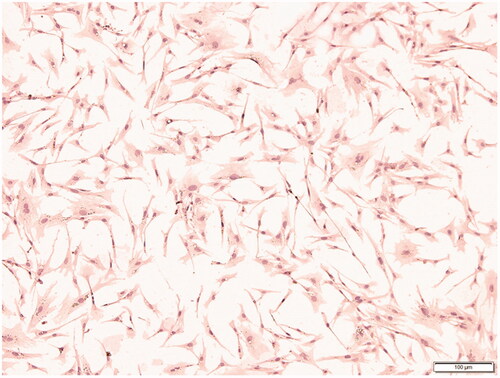 Figure 1. Immunohistochemistry of CD44 protein in preadipocytes (100×).