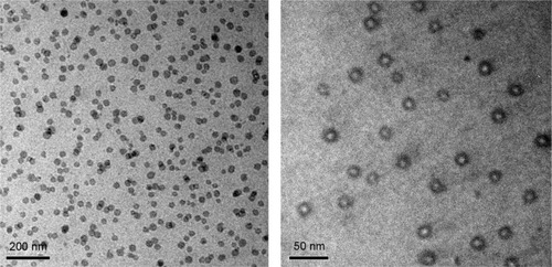 Figure 2 TEM images of Tf/Tet-1-POs (bar 200 and 50 nm).Abbreviations: TEM, transmission electron microscopy; Tf, transferrin; POs, polymersomes.