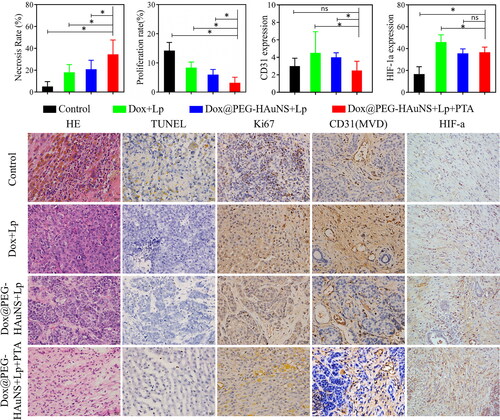 Figure 3. Histopathologic examination of tumour tissues in the four study groups. Tissue sections were stained with haematoxylin and eosin (H&E), TdT-mediated dUTP nick-end labelling (TUNEL), tumour proliferation marker (Ki67 antigen), cluster of differentiation (CD)31, and hypoxia-inducible factor 1a (HIF-1a). Intra-hepatic arterial injections of doxorubicin-loaded hollow Au nanospheres coated with PEG combined with photothermal ablation significantly inhibited tumour growth.