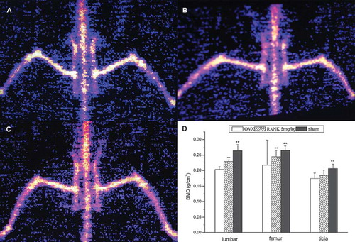 Figure 7. Bone density detection showed that 12 weeks after ovariectomy the bone density of the lumbar spine and femur in the OVX group (A) decreased significantly, and there was a significant difference compared with the sham group (C), indicating that 12 weeks after ovariectomy, the bone osteoporosis models were established; the bone density in the RANK group (B) was significantly higher than the OVX group, indicating that RANK significantly inhibited the ovariectomy-induced bone loss, while the tibial bone density of the OVX group was not statistically different from the RANK group (D) (lumbar spine: F = 54.867, P < 0.000; femur: F = 21.69, P <0.000, tibia: F = 7.299, P < 0.01.