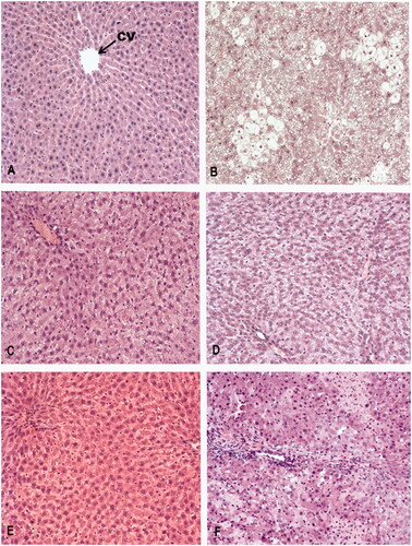 Figure 3. Haematoxylin/eosin staining of representative liver sections from: (A) normal control rats administered vehicle (VE + VCT); (B) damaged control rats administered CT (VE + CT); (C) control rats administered Bocfal EO (Bocfal EO + VCT); (D) damaged rats administered Bocfal EO (Bocfal EO + CT); (E) control rats administered DADS (DADS + VCT) and (F) damaged rats administered DADS (DADS + CT). Central vein (CV), original magnification: 10×.