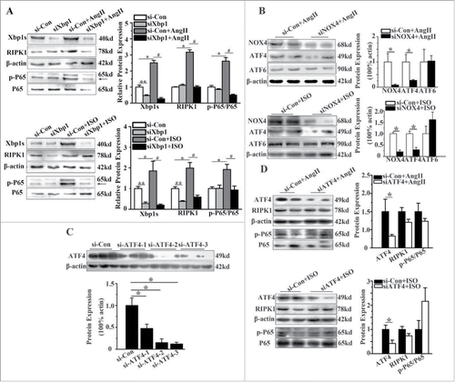 Figure 5. RIPK1-related NF-κB signaling pathway was regulated by Xbp1s. (A) Western blotting analysis for RIPK1 and phosphorylation of P65 subunit of NF-κB in NCMs in the presence or absence of AngII (10−5M for 24h, Top) or ISO (10−5M for 24h, Bottom) after transfected with of si-Con or siXbp1. n = 3. *, ** indicates P<0.05 vs. si-Con, # indicates P<0.05 vs. si-Con+AngII or si-Con+ISO. (B) Western blotting analysis for ATF4 and ATF6 in NCMs treated with AngII (10−5M for 24 h, Top) or ISO (10−5M for 24h, Bottom) after transfected with siNOX4. n = 4. * indicates P<0.05 vs. si-Con+AngII. (C) Western blotting analysis for ATF4 in NCMs transfected with si-Con or siATF4(1–3). n = 3. * indicates P<0.05 vs. si-Con group. (D) Western blotting analysis for RIPK1 and phosphorylation of P65 subunit of NF-κB of in NCMs in the presence or absence of AngII (10−5M for 24h, Top) or ISO (10−5M for 24h, Bottom) after transfected with of si-Con or siATF4. n = 3. * indicates P<0.05 vs. si-Con group.