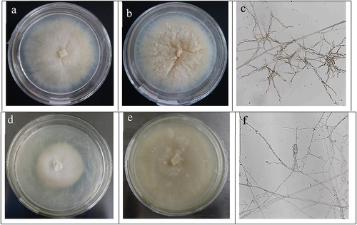 Figure 5. The morphology of the colony and mycelium of the mycorrhizal fungi FQXY019 and FQXY017. FQXY019 colonies were at the early stage (a); FQXY019 colonies were at the later period (b); mycelium of FQXY019 (c); FQXY017 colonies were at the early stage (d); FQXY017 colonies were at the later period (e); mycelium of FQXY017 (f).