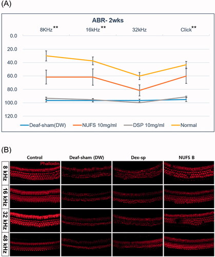 Figure 7. The therapeutic effect of NUFS B in an ototoxic animal model. (A) The auditory brainstem response (ABR) thresholds of the three groups were measured on day 14 after induction of deafness. Only the 10 mg/mL NUFS B group exhibited significantly better hearing than the other two groups at 8 and 16 kHz and the click sound. The statistical results are shown in the text. The data represent the mean ± SD from three independent experiments performed in duplicate. *p<.05, **p<.01, and ***p<.001. (B) We observed the whole organ of Corti using confocal microscopy, focusing on four specific areas of the place-frequency map. The stereocilia of the deaf-sham group and the Dex-SP group were highly damaged at all frequency areas, whereas those of NUFS B group showed less damage than those of the other two groups.