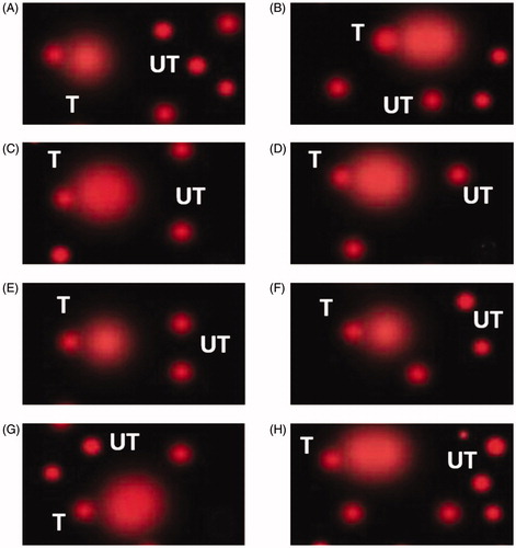 Figure 1. Evaluation of DNA damage in the rabbit's hepatic cells using the comet assay. The photos show the electrophoretic DNA pattern as tailed (T) and untailed (UT) DNA. (A) New Zealand white control at five-week, NZWC (B) NZWT New Zealand white exposed to early acute heat-stress at five-week, (C) Baladi Black control at five-week BBC, (D) BBT Baladi Black exposed to early acute heat-stress at five-week, (E) NZWC2 New Zealand white control exposed to heat stress at 13 weeks (single exposure), (F) NZWT2 New Zealand white exposed for the second time to heat stress at 13 weeks (Double exposure), (G) BBC2 Baladi Black control exposed to heat stress at 13 weeks(single exposure) and (H) BBT2 Baladi Black exposed for the second time to heat stress at 13 weeks (Double exposure). At week 5 of age, only heat stress exposed groups were subjected to acute heat stress (36 °C 62% RH for 6h). At week 13 of age, all the experimental rabbit groups were subjected to acute heat stress (36 °C 62% RH for 6h).