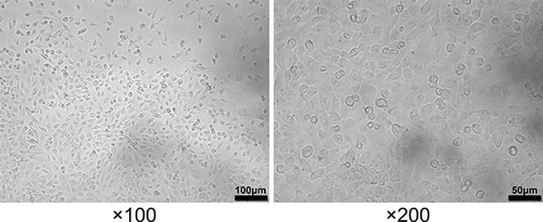 Figure 3 Morphology of HUVECs in the presence of HSP serum.