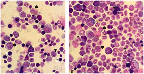 Figure 7. Cytospin preparation of bone marrow. Abundant presence of myeloid cells in the bone marrow cell population after being treated with 128 mg/kg Cu2CO3(OH)2 NPs for five consecutive days (day 1–5). The left hand image is the vehicle control (day 6), while the right hand image is the Cu2CO3(OH)2 NP treated animal on day 7. * Myeloid progenitor cells, # erythroid progenitor cells. Magnification ×500.