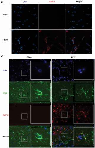 Figure 1. ZIKV infects CCF-STTG1 cells in vitro and astrocytes in the brain of AG6 mice in vivo. (a) CCF-STTG1 cells were infected with ZIKV at an MOI of 3 (TCID50/cell). Subsequently, 24-h post-infection, the cells were used for immunofluorescence analysis. The experiment was repeated three times. ZIKV-E (red), DAPI (blue).10×; (b) Sagittal sections of the brains of AG6 mice on day 5 post-infection. Three mice per group were perfused and paraffin-embedded. GFAP (green), ZIKV-E (red), DAPI (blue).48.4× magnification.(Bar = 50 μm)