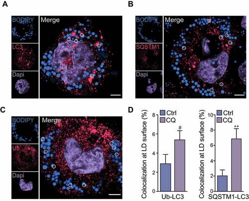 Figure 1. LC3, SQSTM1 and ubiquitin localize to lipid droplets in macrophage foam cells. Human THP-1 macrophages were loaded with agLDL (50 μg/mL) for 30 h and equilibrated in BSA (2 mg/mL) overnight. Cells were then fixed and stained for LC3 (A), SQSTM1 (B), ubiquitin (Ub) (C) and BODIPY 493/503 to label neutral lipids. Lipid droplets (LDs) that were colocalized with LC3, SQSTM1 or Ub are circled. At right, quantification of the percent of cellular LDs tagged with Ub and LC3 or Ub and SQSTM1 colocalized at their surface in chloroquine (CQ)-treated cells as compared to control (Ctrl) is shown. Data are expressed as fold-change for the chloroquine treatment relative to untreated from one experiment representative of 3 independent experiments with similar results (mean ± s.e.m). #P < 0.1, **P< 0.005. Representative images are from untreated cells. Scale bar: 5 μm