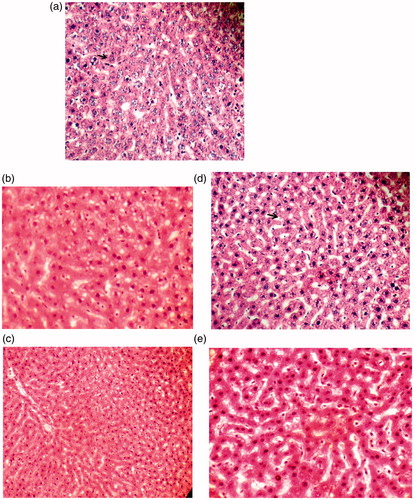 Figure 4. Photomicrograph of liver (a) control group (b) ACEI group (c) EPO + ACEI group (d) ASP group (e) ASP + ACEI group (200 and 400X, H&E Staining).