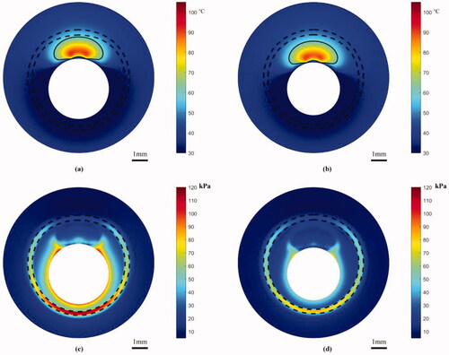 Figure 12. Illustrates the temperature and stress distribution in the X–Y cross-section after 6 s of heating: (a, c) fully expansion case; (b, d) incomplete expansion case. Scale bar: 1 mm.