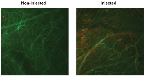 Figure 7 Aβ induces leakage of albumin from the retinal vasculature. Confocal images of retinal flatmounts of blood vessels labelled with antibody to RECA-1 (green) and albumin labelled with antibody raised against albumin (red). Note that the control (left) exhibits little or no albumin leakage, whereas the retina injected with Aβ1–42 (right) exhibits localized leakage around several blood vessels.