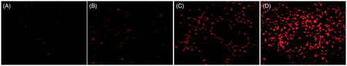Figure 6. Cellular uptake of hPAMAM/DNA in the concentration of 8 μm (A), hPAMAM–PEGDGA/DNA NPs in the concentration of 1, 4 and 8 μm on MCF7 cells after a 30-min incubation (B–D). The weight ratio of PAMAM to DNA was 10:1. Results were performed as fluorescent microscopy images. Red: EMA-labeled DNA. Original magnification: 100×.
