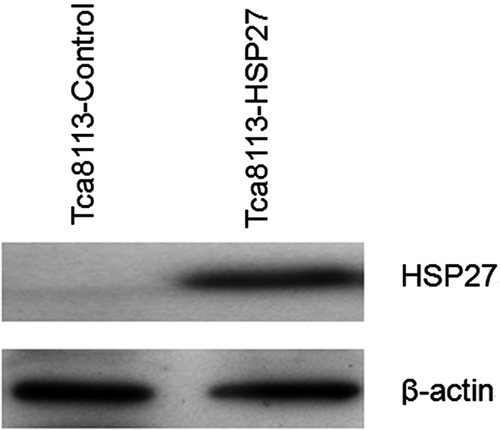 Figure 10. Tca8113 cells were transfected with the control, Hsp27 plasmids for 24 h, respectively. Western blotting showed elevated and stable expression of Hsp27 in Tca8113-Hsp27 cells.