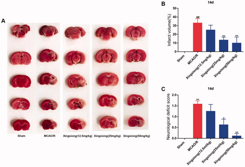 Figure 1. Xingxiong injection reduces the infarction volume and neurologic deficits in rats subjected to MCAO. (A) Effects of Xingxiong injection on infarction volumes (n = 3). (B) Quantitative analysis of cerebral infarct volumes. (C) Neurological score in rats with MCAO/R at 14 d after reperfusion (n = 3). Data are expressed as the mean ± SD and were analysed by ANOVA. ##p < 0.01 vs. sham group; *p < 0.05 and **p < 0.01 vs. MCAO/R group.