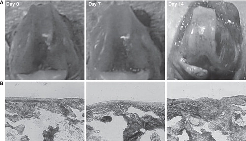 Figure 1. Rat osteoarthritis (OA) model with anterior cruciate ligament transection. A: Macroscopic appearance of the anterior cruciate ligament transection (ACLT) model of rat OA. At 2 weeks post-surgery, the joints have obvious articular surface damage and osteophyte formation around the margin of the medial femoral condyles and the patella groove. B: Toluidine blue staining showing the thickness of gradual degeneration of the patellar groove (Original magnification ×20).