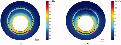 Figure 5. The Von Mises distribution in the Z cross-section when the positive electrode voltage is 25 V: (a) before heating; (b) after heating. The dotted lines represent the boundary of plaque and healthy artery, respectively. Scale bar: 1 mm.