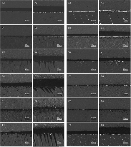 Figure 8 Representative SEM images of the bonded interfaces evaluated after 24 h of water storage (A1–F1 and A2–F2) and after aging for 3 months in water at 37°C plus 10,000 thermocycles (A3–F3 and A4–F4). (A1–A4) No treatment; (B1–B4) No pretreatment + remineralization; (C1–C4) PA/ethanol solution pretreatment + remineralization; (D1–D4) Myricetin/ethanol solution pretreatment + remineralization; (E1–E4) Resveratrol/ethanol solution pretreatment + remineralization; (F1–F4) Kaempferol/ethanol solution pretreatment + remineralization. Magnification: ×1000 (A1–F1 and A3–F3); ×2000 (A2–F2, A4–F4).