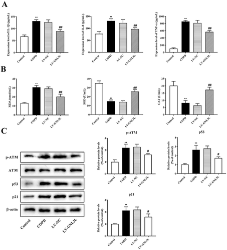 Figure 7 ELISA was executed to detect the expression of inflammatory factors (A) and oxidative stress-related factors (B). (C) Western blot was performed to detect the expression of ATM/p53 pathway-related proteins in the tissues. Compared with the Control group, **p<0.01; compared with the LV-NC group, #p<0.05, ##p<0.01.