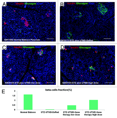 Figure 1. Confocal microscopic images of insulin (red), glucagon (green), and Dapi (blue). (A) Baboon ID#11692, normal baboon pancreas; (B) Baboon ID#18175, STZ plus UTMD pBIP3.1-DsRed reporter gene; (C) Baboon ID#26104, STZ plus UTMD-pBIP3.1-cyclinD2/CDK4/GLP-1 genes (12 mg of plasmid); (D) Baboon ID#20105, STZ plus UTMD-pBIP3.1-cyclinD2/CDK4/GLP-1 genes (20 mg of plasmid); scale bar is 120 µm. (E) The lower panel displays the percentage of β-cell area in total pancreatic area (%).