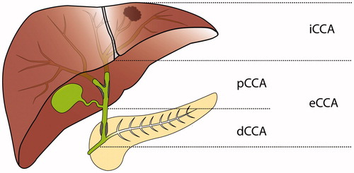 Figure 1. Current classification of cholangiocarcinoma: dCCA: distal cholangiocarcinoma; eCCA: extrahepatic cholangiocarcinoma; iCCA: intrahepatic cholangiocarcinoma; pCCA: perihilar cholangiocarcinoma.