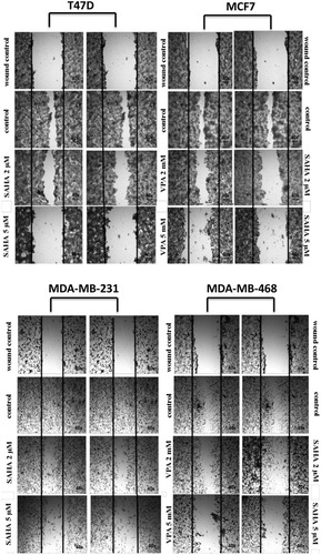 Figure 2 Effect of VPA and SAHA on migration of T47D, MCF7, MDA-MB-231 and MDA-MB-468 breast cancer cells in wound-healing assay.Notes: Scratched monolayers of T47D, MCF7, MDA-MB-231 and MDA-MB-468 cells were incubated for 24 hrs alone (control) or in the presence of VPA (2 mM, 5 mM) or SAHA (2 µM, 5 µM). Representative images from 3 independent experiments are shown. Magnification 40×.Abbreviations: SAHA, vorinostat; VPA, valproic acid.