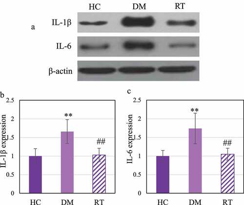 Figure 6. Comparison on differences in the expression levels of IL-1β and IL-6 protein in the hippocampus of rats in each group.