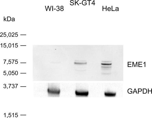 Figure S2 Western blot analysis evaluating EME1 primary antibody in HeLa, WI-38, and SK-GT4 cell extracts. One major band can be seen at expected size of 65 kDa in both HeLa and SK-GT4 cell extracts. The band is present but much weaker in the WI-38 cell line.Abbreviation: GAPDH, glyceraldehyde 3-phosphate dehydrogenase.