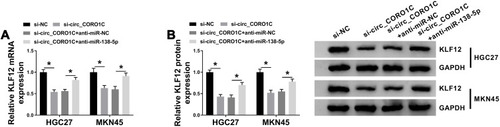 Figure 7 Circ_CORO1C positively regulated KLF12 by sponging miR-138-5p in GC cells. HGC-27 and MKN45 cells transfected with si-NC, si-circ_CORO1C, si-circ_CORO1C+anti-miR-NC or si-circ_CORO1C+anti-miR-138-5p. (A and B) QRT-PCR and Western blot assays for the mRNA and protein levels of KLF12 in transfected cells. *P <0.05.