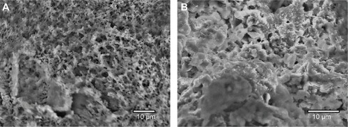 Figure 4 SEM microphotographs of poly (VT-co-VP) copolymer (A) and silver nanoparticles nanocomposite (B).Notes: Magnification (A) 2000×; magnification (B) 3000×.Abbreviation: SEM, scanning electron microscopy; poly (VT-co-VP), copolymer of 1-vinyl-1,2,4-triazole and N-vinylpyrrolidone.
