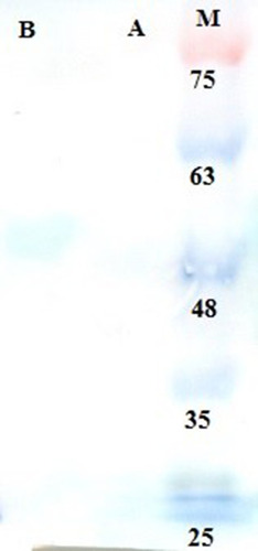 Figure 2 Western blot analysis of purified recombinant protein of α-toxin-6×His tags. M: prestained Protein Ladder (Sinaclon, Iran). Lane A: Negative control E. coli strain BL21 (DE3). Lane B purified recombinant protein of E. coli BL21 (DE3) transformed with pET28a/-α-toxin-6×His tags shows one band at 48 kDa.