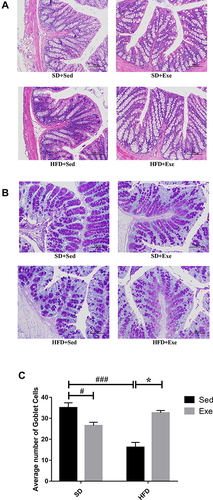 Figure 6 H&E and PAS staining sections of the colon tissues of mice. (A)The effect of moderate exercise on the pathological changes of the colon on mice. (B and C) The effect of moderate exercise on the GCs changes of the colon in the different groups. Scale bar: 100μm. The results were represented as mean±SEM (n= 3 each group). *P <0.05, compared to HFD + Sed group; #P<0.05, ###P<0.001, compared to SD + Sed group.