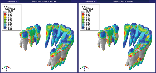 Figure 5. Stress acting on the teeth.