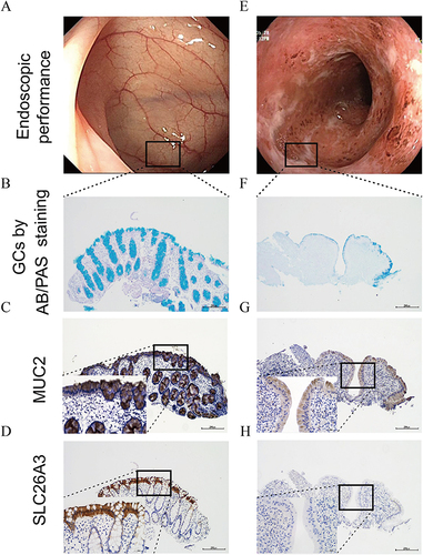 Figure 2 Representative images of mucus barrier-related markers in patients with endoscopic remission compared to patients with active lesions.