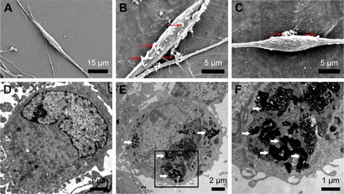 Figure 3 Cellular internalization of PEI-SPIONs.Notes: (A) SEM photomicrograph of normal control SCs; no particles can be detected. (B and C) Six hours after magnetofection, SCs were treated with PEI-SPIONs (4 μg/mL); red arrows indicate the aggregated PEI-SPIONs on the cell surface. (D) TEM analysis of normal control SCs showed no PEI-SPIONs in the cytoplasm. (E and F) Twenty-four hours after magnetofection, SCs were treated with PEI-SPIONs (4 μg/mL); white arrows indicate the internalized PEI-SPIONs in the cytoplasm. (F) A higher magnification of the boxed area in (E).Abbreviations: PEI-SPIONs, polyethylenimine-coated superparamagnetic iron oxide nanoparticles; SCs, Schwann cells; SEM, scanning electron microscopy; TEM, transmission electron microscopy.
