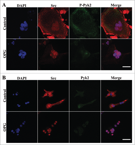 Figure 5. The increase of Src/Pyk2 association in OCs after OPG treatment. Cells were plated and cultured on coverslips as described in the Methods. Cells treated with 40 ng/mL OPG for 24 h (lower images), or untreated (upper images), were fixed and stained for DAPI, Src and either p-Pyk2 402 or Pyk2 and examined by confocal immunofluorescence microscopy. (A) Distribution of p-Pyk2 402 and Src. (B) Distribution of Pyk and Src. OPG treatment inhanced the colocalization of Pyk2 and Src in the central region of OCs. Scale bar = 20 μm.