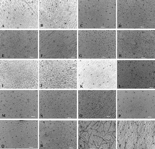 Fig. 3 Stomatal micrographs of 10 lettuce cultivars (20× magnification). Each pair of micrographs shows the adaxial (left) and the abaxial (right) sides of the same leaf for one cultivar. The cultivars used were as follows: ‘Batavia Reine des glaces’ (a, b), ‘Chief’ (c, d), ‘Estival’ (e, f), ‘Gorilla’ (g, h), ‘Hochelaga’ (i, j), ‘Little Gem’ (k, l), ‘Parris Island Cos’ (m, n), ‘Romora’ (o, p), ‘Turbo’ (q, r) and ‘Vista Verde’ (s, t).