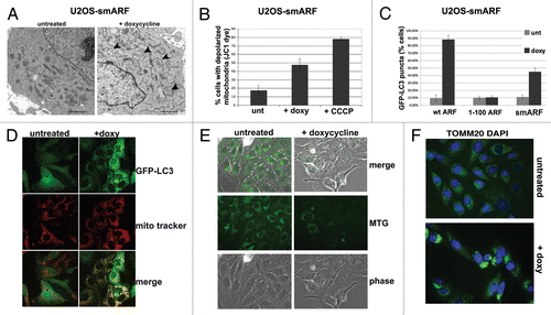 Figure 4. smARF induces morphological indicators of mitophagy. (A) Electron microscopy of U2OS-smARF cells untreated or treated with doxycycline for 48 h (0.1 µg/mL). The arrowheads indicate swollen mitochondria evident after smARF induction. The data depicted are representative of several independent experiments, and two different subclones of U2OS-smARF cells. Scale bar: 500 nm. (B) U2OS-smARF cells were treated with either doxycycline (doxy, 0.1 µg/mL) or a positive control (the mitochondrial uncoupler carbonyl cyanide m-chlorophenylhydrazone, CCCP, 10 μM) for 48 h or left untreated (unt). The mitochondrial transmembrane potential was measured using the flow cytometry-based MitoPotential assay from Millipore (Guava EasyCyte). Note that induction of smARF increases the percentage of cells with depolarized mitochondria. The graph depicts data from three independent experiments, with standard error. (C) U2OS-ARF cells were transiently transfected with GFP-LC3 plasmid for 24 h, treated with doxycycline for 48 h (0.1 µg/mL) and examined by confocal microscopy. The chart shows the percentage of cells containing more than four GFP-LC3 vacuoles compared with untreated controls. The results are the average plus standard error of three independent experiments in which at least 200 cells were counted for each sample. (D) Immunofluorescence analysis of U2OS-smARF cells transiently transfected with GFP-LC3 plasmid for 24 h, then untreated or treated with doxycycline for 48 h (0.1 µg/mL) and stained with MitoTracker Red. The bottom panels depict the colocalization of GFP-LC3 vacuoles with MitoTracker stain following smARF induction. (E) U2OS cells with inducible smARF were left untreated or incubated with 0.1 µg/mL doxycycline for 48 h, and mitochondrial mass was assessed following incubation with MitoTracker Green (MTG). The data depicted are representative of three independent experiments. (F) U2OS cells with inducible smARF were left untreated or incubated with 0.1 µg/mL doxycycline for 24 h, and then analyzed by immunofluorescence for TOMM20. The data depicted are representative of three independent experiments.