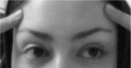Figure 3 Desired eyebrow position is depicted by one of the subject’s own finger in the mirror.