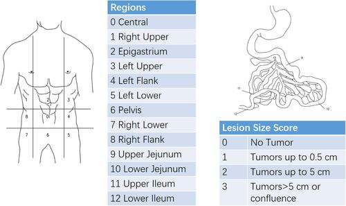 Figure 1 Peritoneal Cancer Index (PCI) scoring system.Citation7