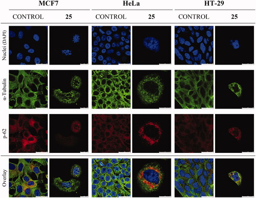 Figure 4. Effect of compound 25 (175 nM) on the microtubule system and autophagy of MCF7, HeLa, and HT-29 cells after 72 h of treatment. Microtubules were stained with anti-α-tubulin antibody (green fluorescence), p-62 protein with anti-SQSTM1/p62 antibody (red fluorescence), and cell nuclei with DAPI (blue fluorescence). Preparations were analysed by confocal microscopy. Control cells were run in parallel. Scale bar: 25 µm. The photomicrographs shown are representative of three independent experiments.