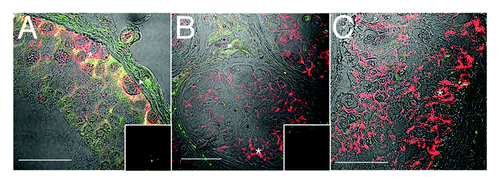 Figure 5. ZO-1 localization is disorganized in carcinoma in situ, in the presence of normal connexin 43 reactivity. Confocal immunofluorescence of normal human testis (A) and carcinoma in situ (B) detecting ZO-1 (tight and associated junctions, red, asterisks) and connexin 43 (gap junctions, green, triangles). Inserts are negative controls. (Bar = 50 µm).