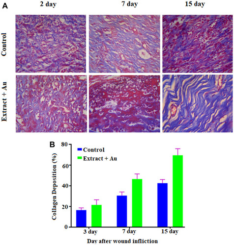 Figure 11 (A) Masson’s Trichrome staining images of regenerated structure of incised wounds in different days (3, 7 and 15) for treated with control, and extract containing AuNPs at 10x magnifications (scale bar 100 μm); (B) Histogram of collagen deposition (in %).Abbreviation: AuNPs, gold nanoparticles.