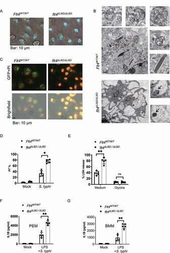 Figure 2. FLT4 protects macrophages from pyroptosis during clearance of S. typhimurium. (A and B) Representative images of S. typhimurium-RFP infected Flt4WT/WT and flt4∆LBD/∆LBD PEMs for 2 h by live-cell spinning disk confocal laser microscopy (A) or by electron microscopy analysis (B), numerous phago-lysosomal vacuoles with membrane containing bacteria remnants were highlighted by white arrows. The intact bacteria in flt4∆LBD/∆LBD PEMs were highlighted by black arrows. Representative images from three independent experiments. Scale bar: 500 nm. (C and D) Flt4WT/WT and flt4∆LBD/∆LBD PEMs were infected with S. typhimurium-GFP for 1 h, followed by staining with PI. The percentages of PI+ cell was analyzed from at least 200 cells. Data are the mean ± SEM Representative images were shown. *p < 0.05, **p < 0.01. (E) Flt4WT/WT and flt4∆LBD/∆LBD PEMs were infected with S. typhimurium in the presence of the medium control or glycine that nonspecifically inhibits ion fluxes. LDH released by dying cells was quantified at least 200 cells. Data are presented as the mean ± SEM *p < 0.05, **p < 0.01 (F and G) Flt4WT/WT and flt4∆LBD/∆LBD PEMs (F) or BMDM (G) were treated with LPS (1 μg/ml, 4 h) followed by S. typhimurium infection for 30 min. IL1B concentrations in supernatants were examined by ELISA. Data are presented as the mean ± SEM *p < 0.05, **p < 0.01.