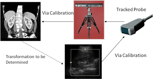 Figure 2. Conventional tracked ultrasound approach for US-to-CT registration.