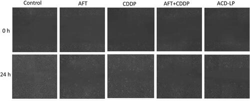 Figure 6 Migration of HONE1 cells after treatment with different formulations. Images were captured at 0 and 24 h using the Axiovert 200M microscope (Zeiss) equipped with the CoolSNAP ES camera.