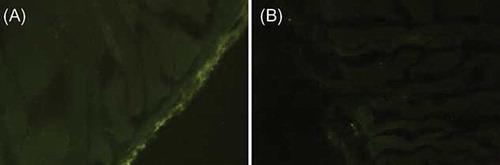 Figure 2.  The immunofluorescence microscope images show the peritoneum slides, MSC group (A) and P group (B). GFP-labeled MSCs were observed along the mesothelium line in the MSC group (A) but were absent in the P group (B).